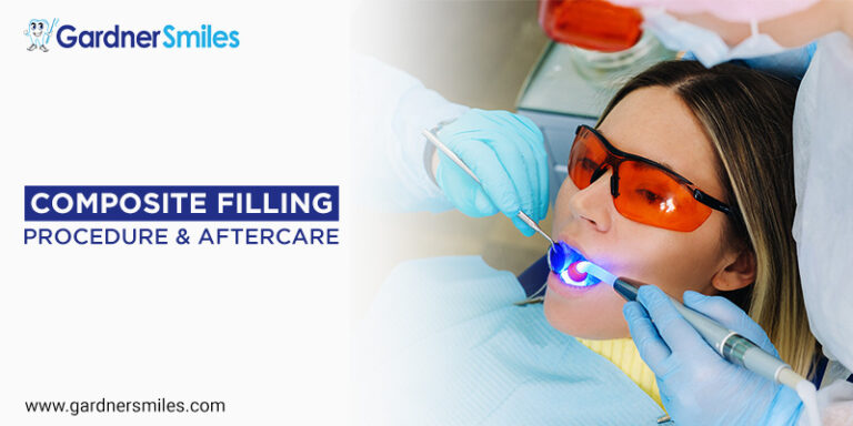 What Is A Composite Filling Procedure Aftercare Gardner Smiles